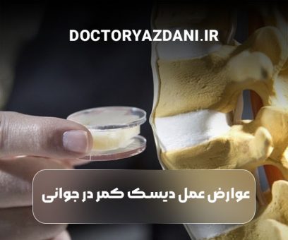 عوارض عمل دیسک کمر در جوانی